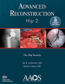 Advanced Reconstruction Hip 2
