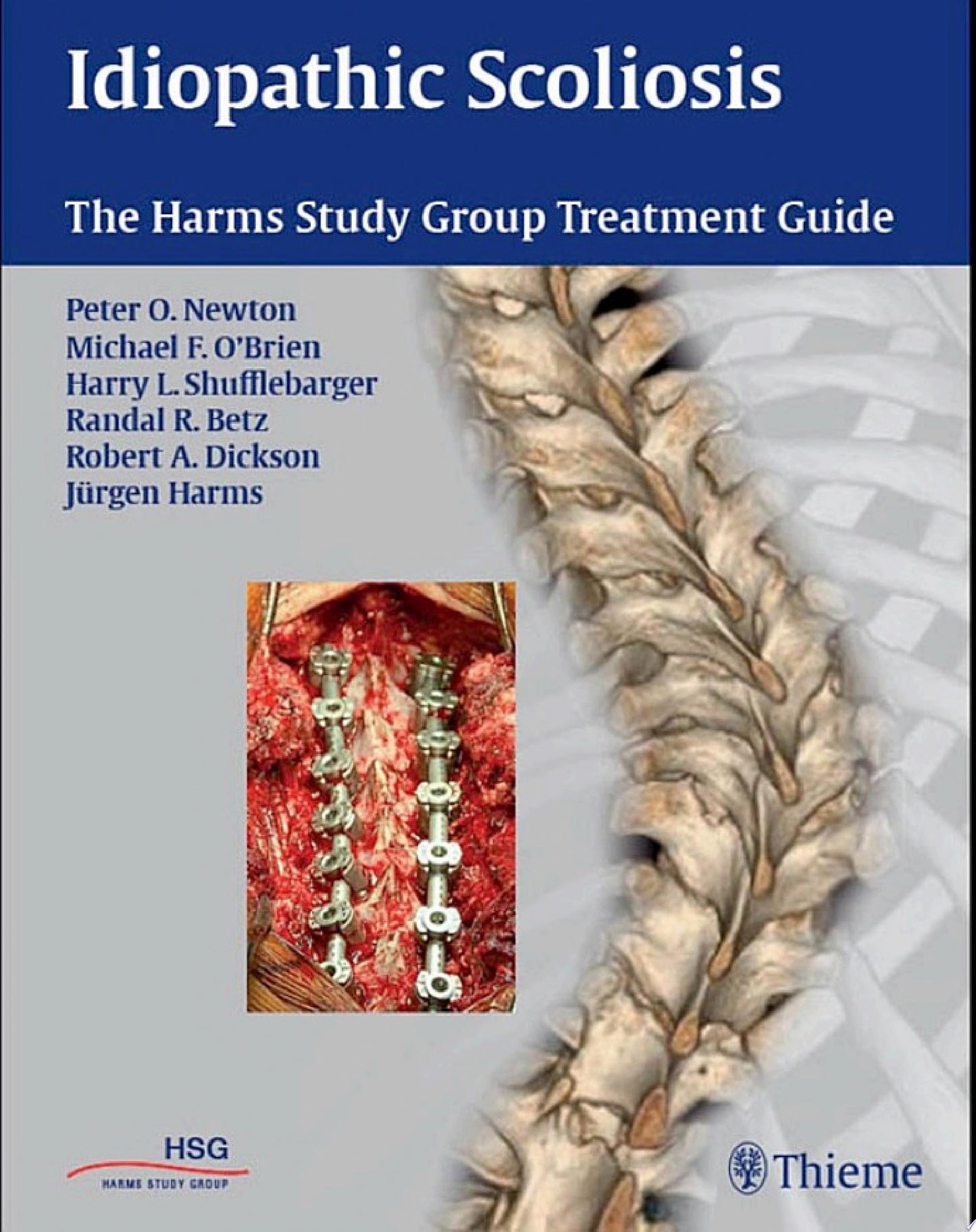 Idiopathic Scoliosis: The Harms Study Group Treatment Guide