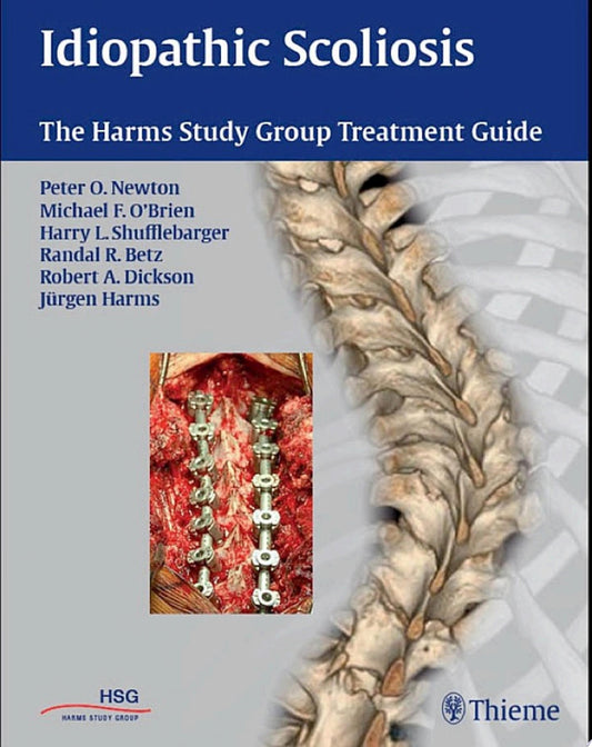 Idiopathic Scoliosis: The Harms Study Group Treatment Guide