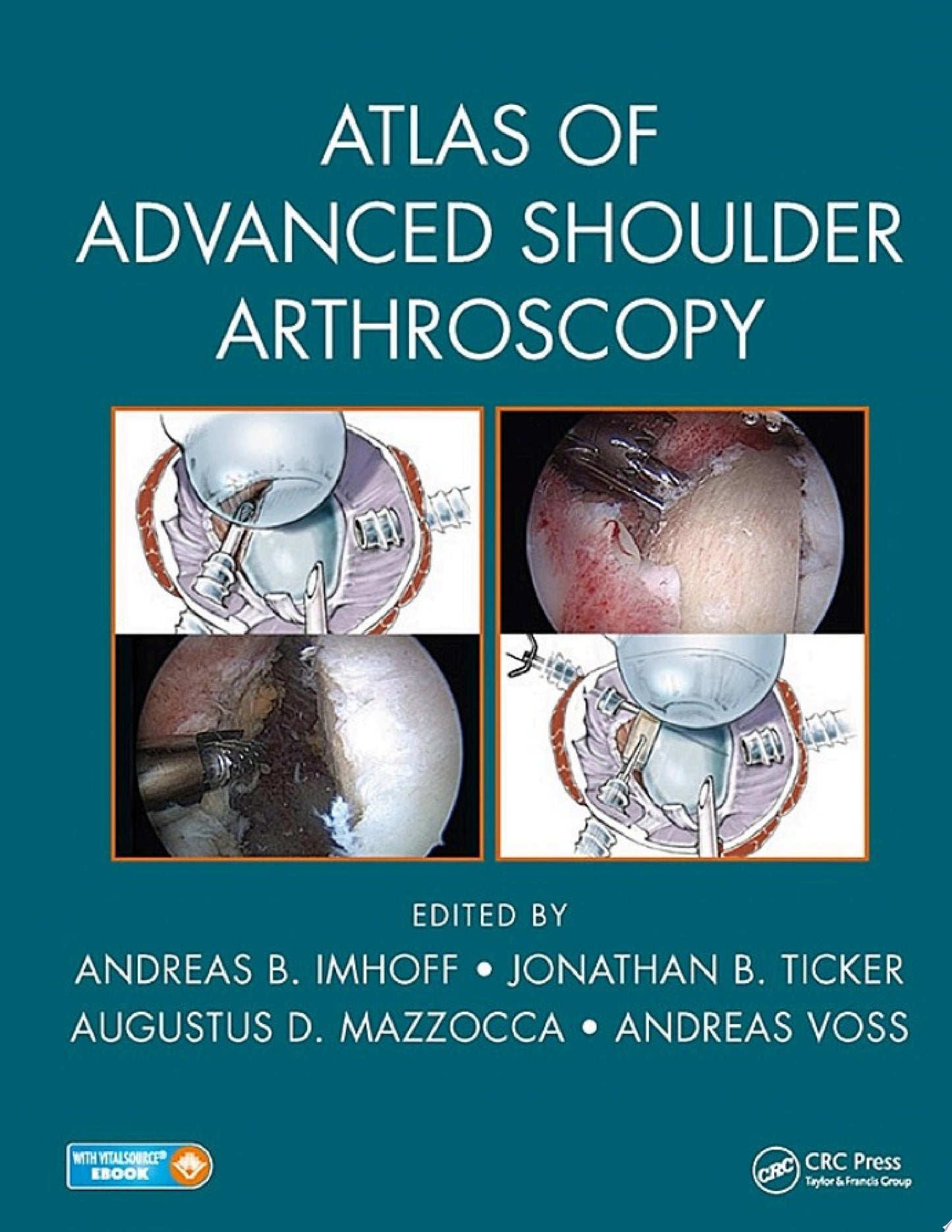 Atlas of Advanced Shoulder Arthroscopy
