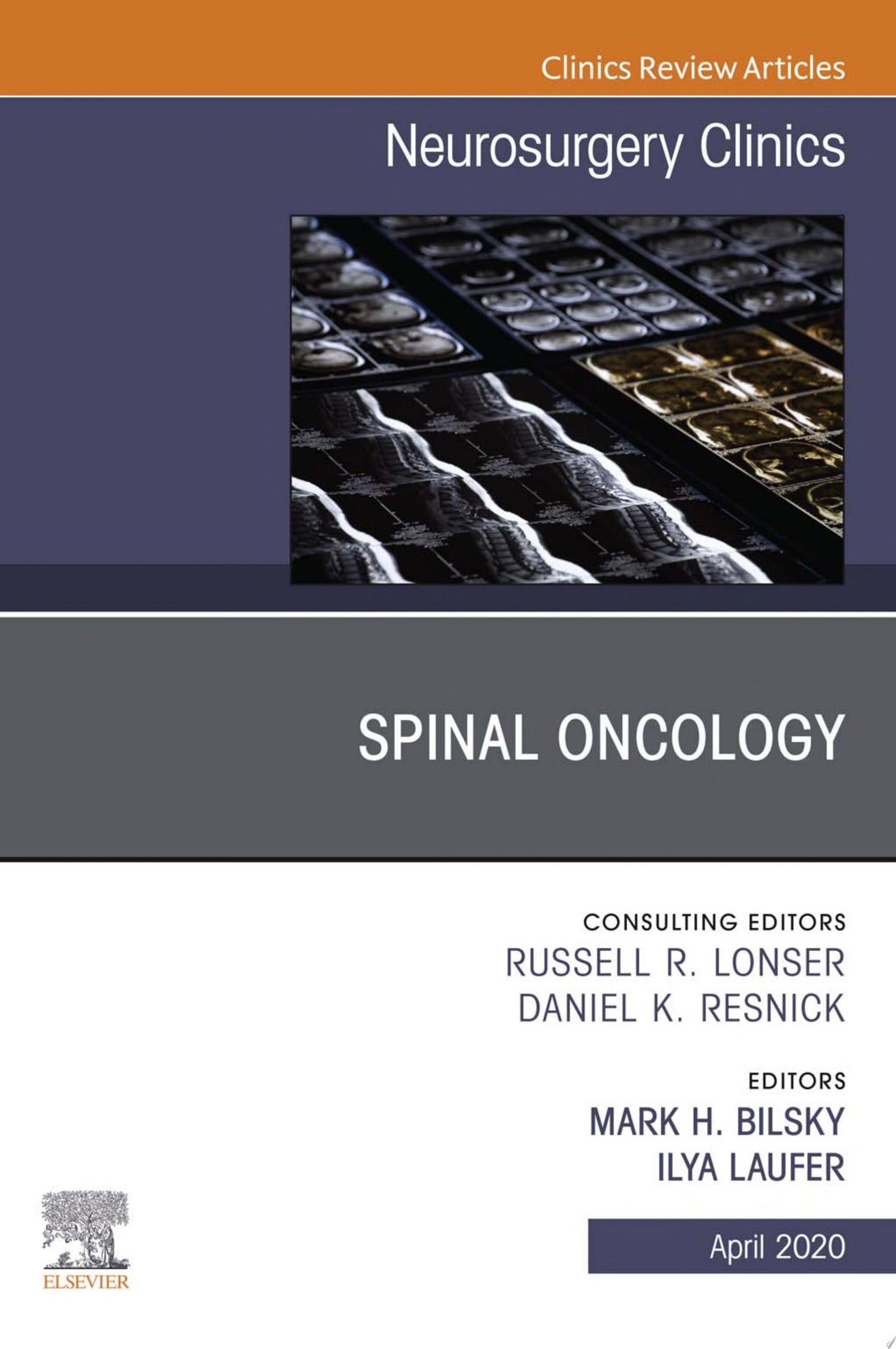 Spinal Oncology An Issue of Neurosurgery Clinics of North America