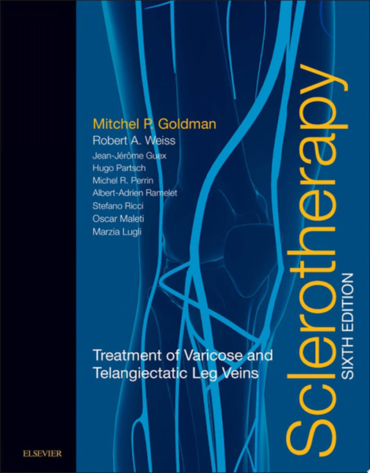 Sclerotherapy: Treatment of Varicose and Telangiectatic Leg Veins, 6th Edition