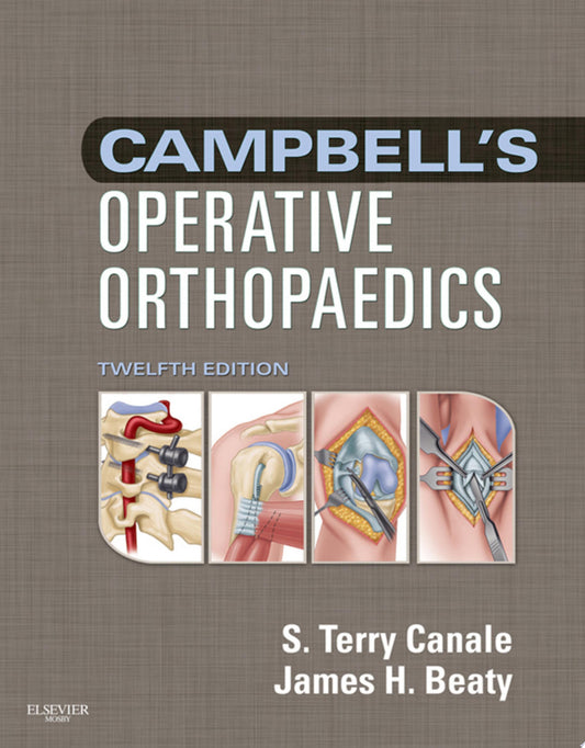 Campbell’s Operative Orthopaedics: 4-Volume Set, 12th Edition
