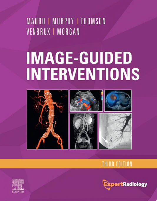 Image-Guided Interventions: Expert Radiology Series , 2e