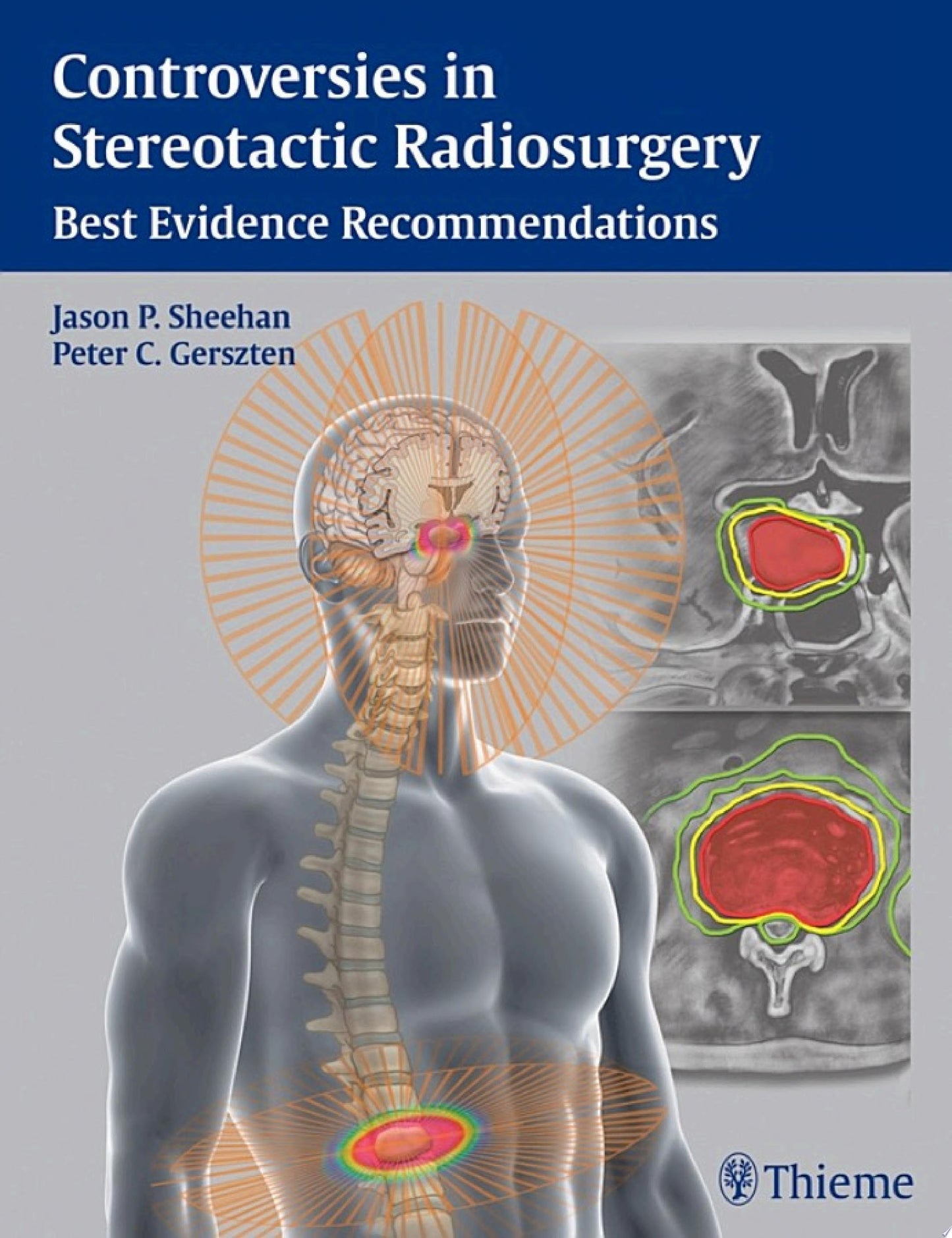 Controversies in Stereotactic Radiosurgery: Best Evidence Recommendations