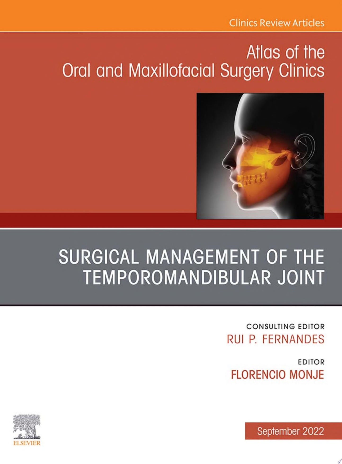 Temporomandibular Joint Surgery, An Issue of Atlas of the Oral & Maxillofacial Surgery Clinics