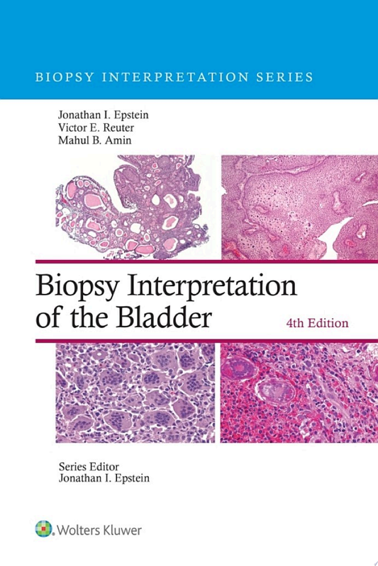 Biopsy Interpretation of the Bladder , 4th Edition