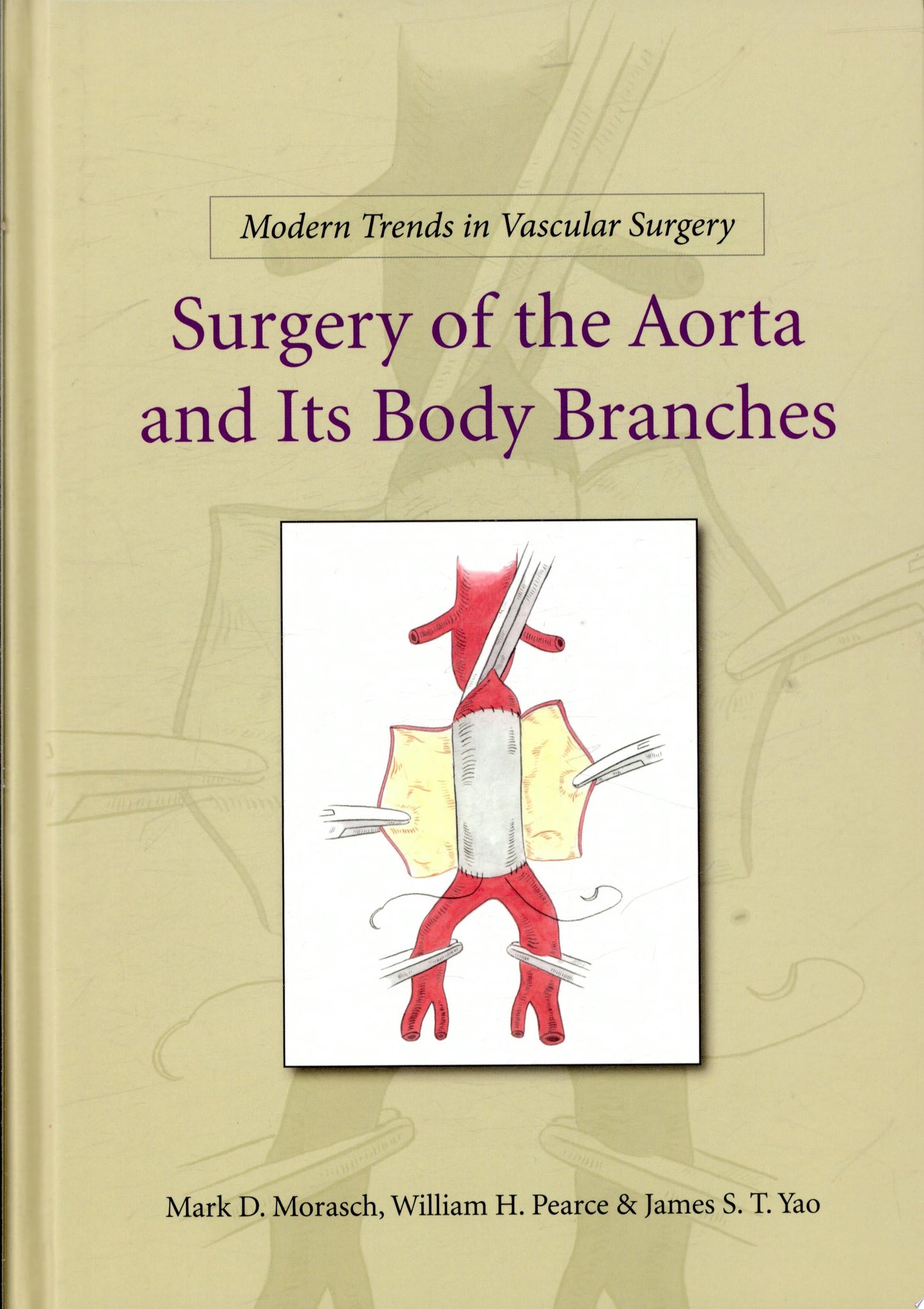 Modern Trends in Vascular Surgery: Surgery of the Aorta and Its Body Branches