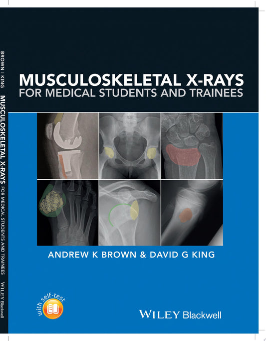Musculoskeletal X-Rays for Medical Students and Trainees