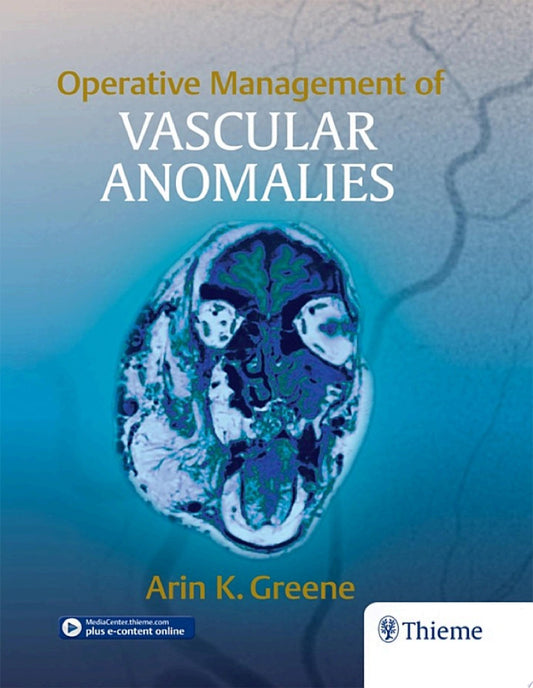 Operative Management of Vascular Anomalies