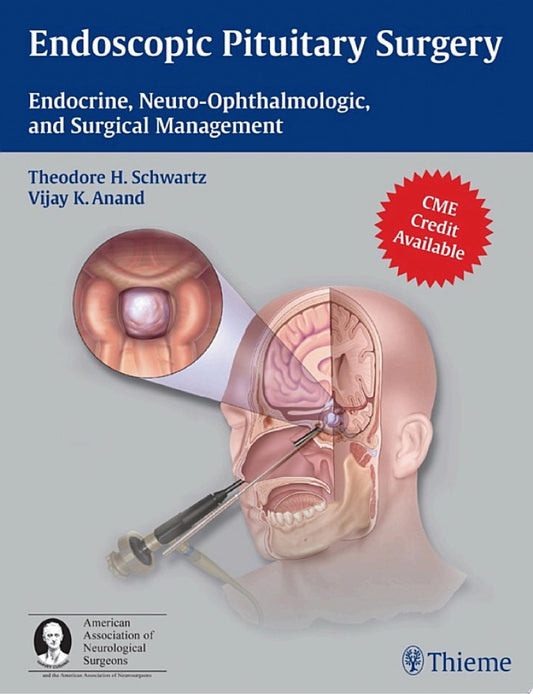 Endoscopic Pituitary Surgery: Endocrine, Neuro-Ophthalmologic and Surgical Management