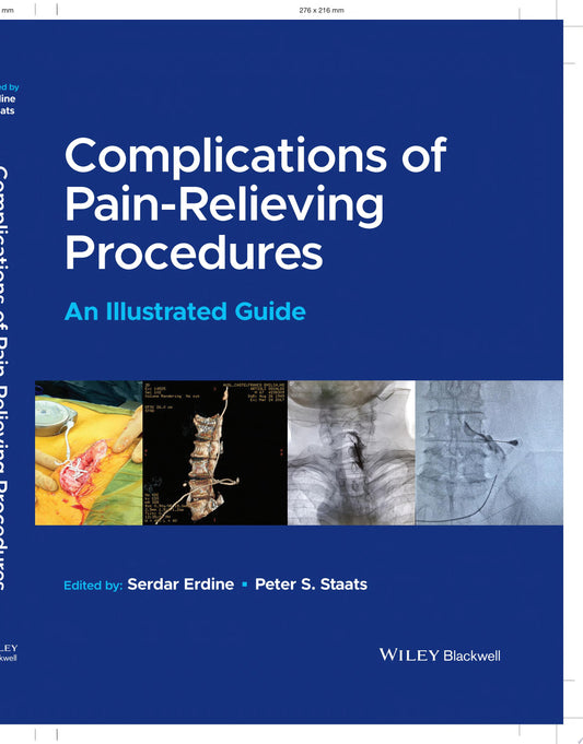 Complications of Pain-Relieving Procedures: An Illustrated Guide