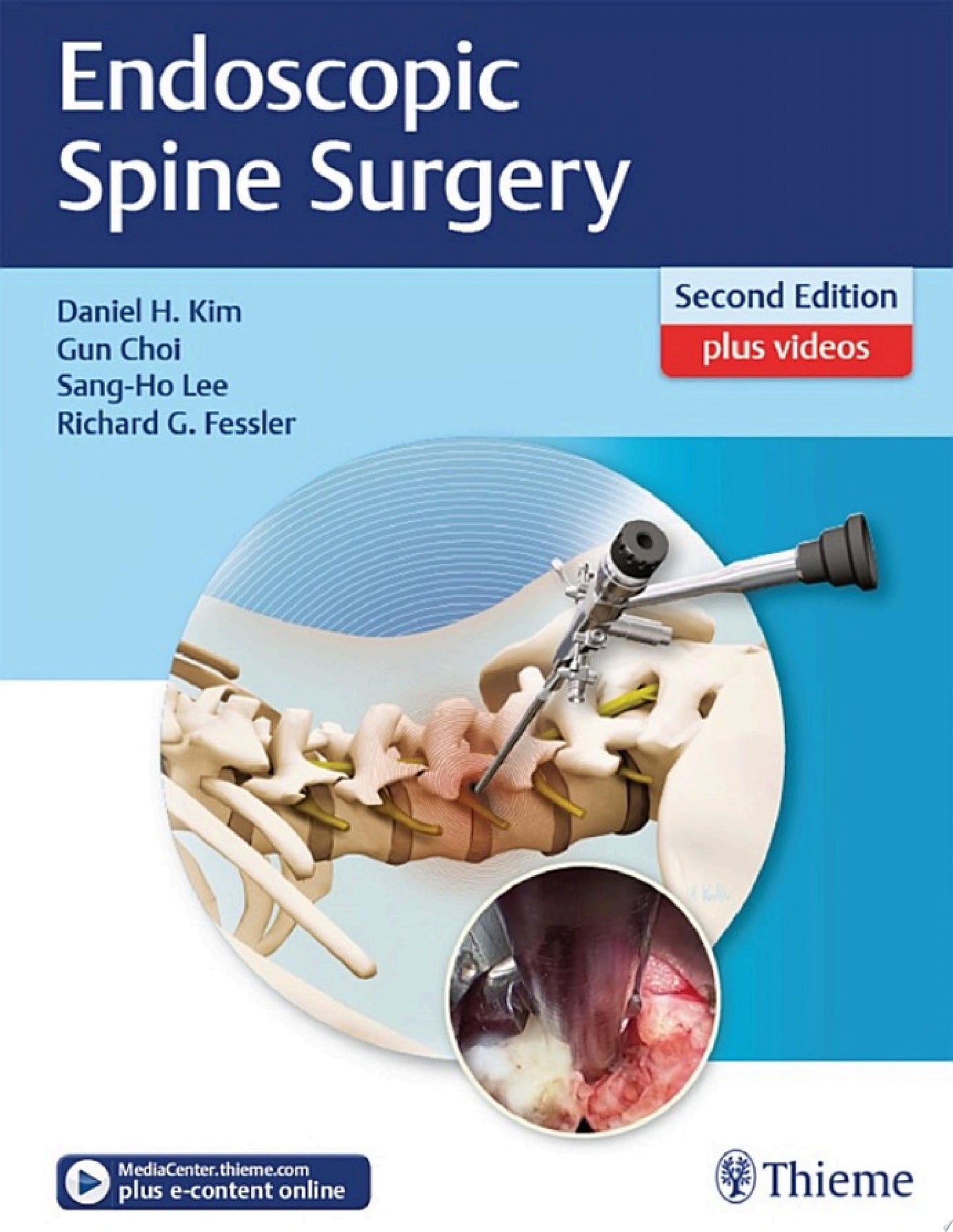 Endoscopic Spine Surgery, 2nd Edition