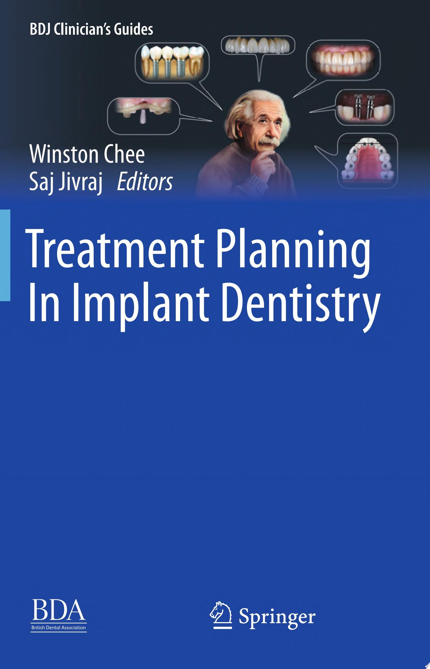 Treatment Planning In Implant Dentistry , 2nd Edition