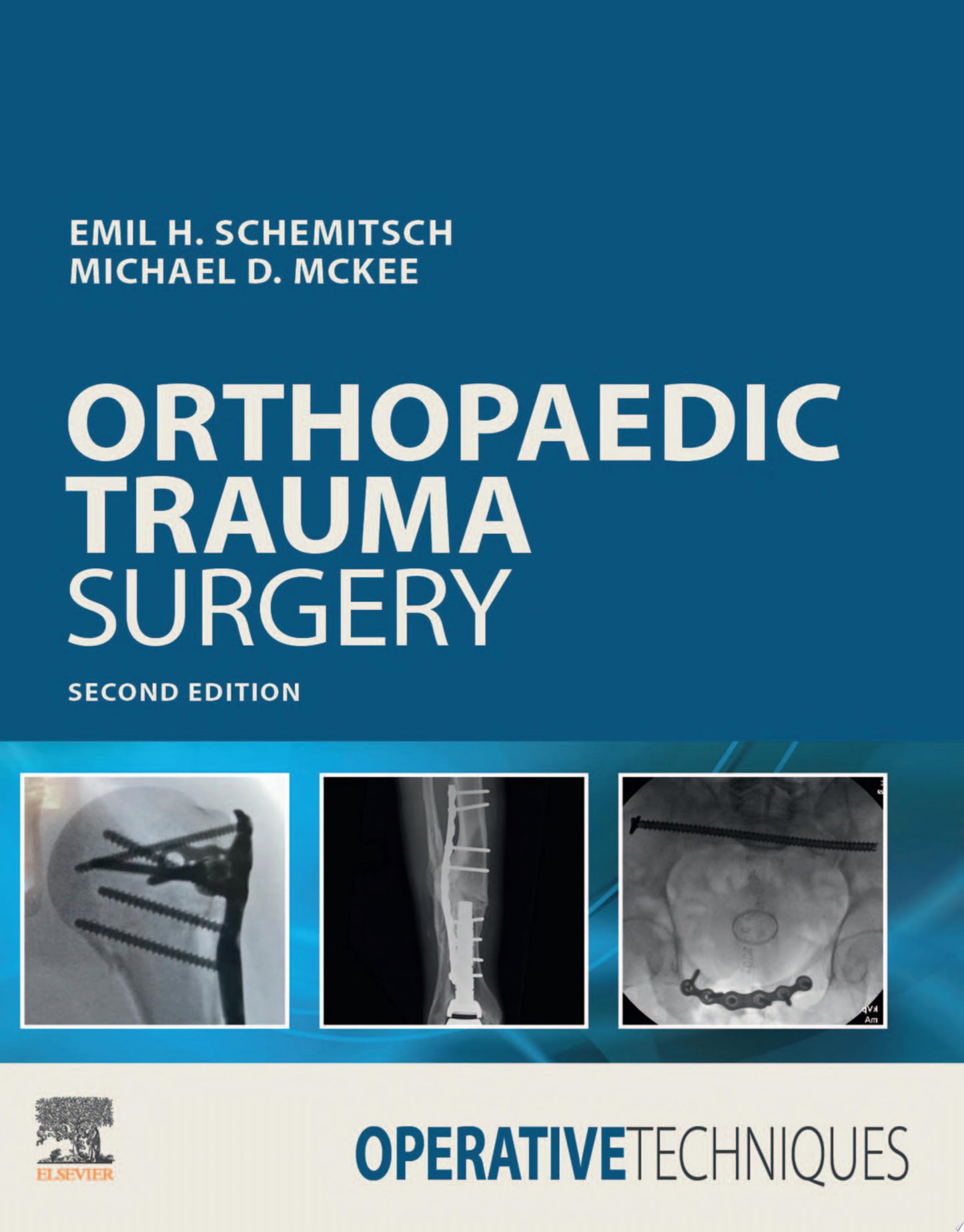 Operative Techniques: Orthopaedic Trauma Surgery, 2nd Edition