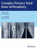 Complex Primary Total Knee Arthroplasty