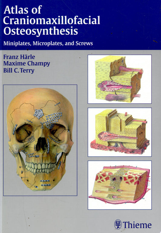 Atlas of Craniomaxillofacial Osteosynthesis: Microplates, Miniplates, and Screws, 2nd Edition