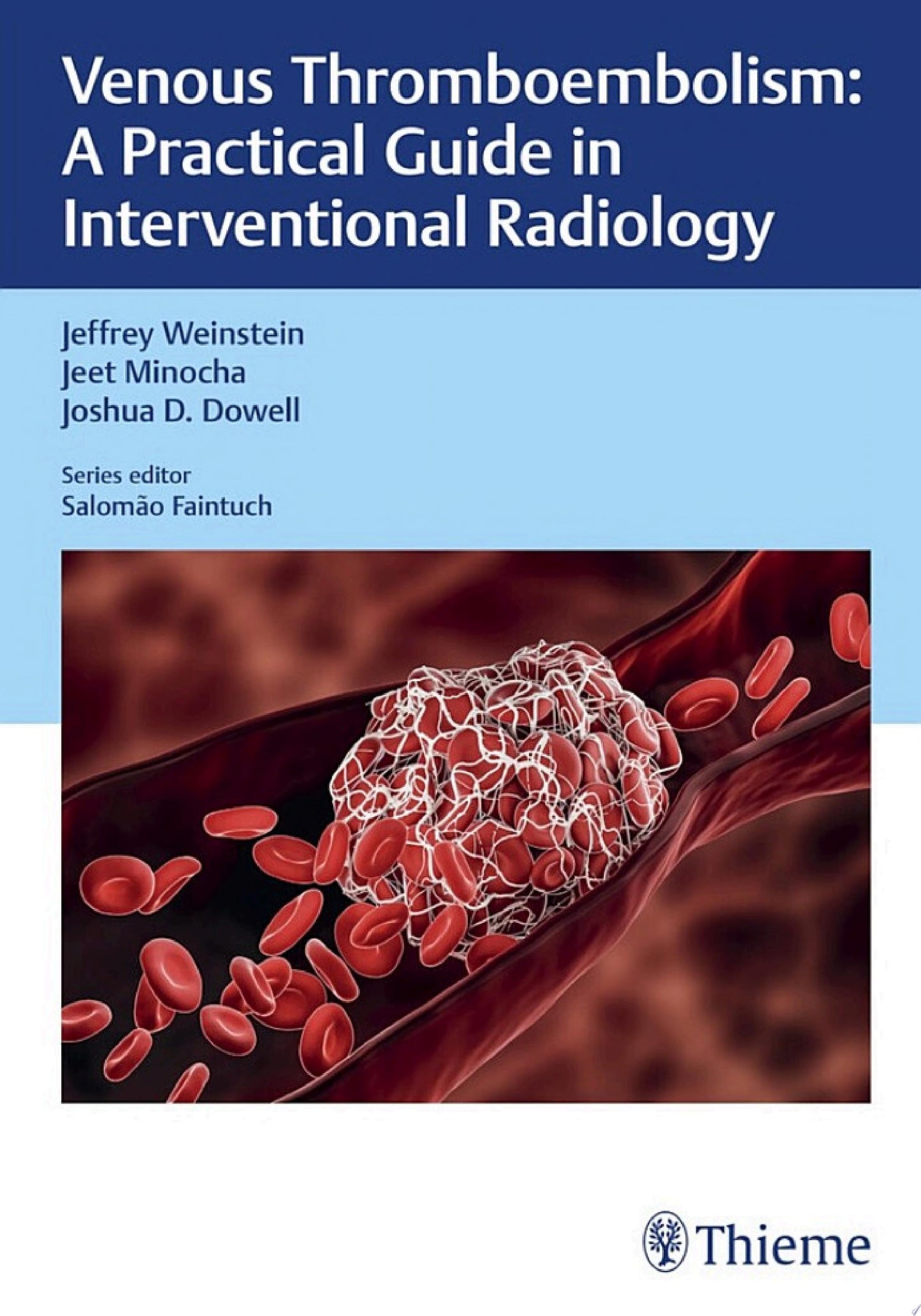 Venous Thromboembolism: A Practical Guide in Interventional Radiology