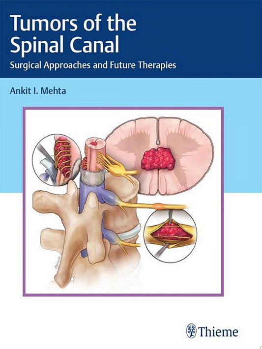 Tumors of the Spinal Canal: Surgical Approaches and Future Therapies