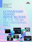 Ultrasound-guided nerve blocks of the trunk and abdominal wall