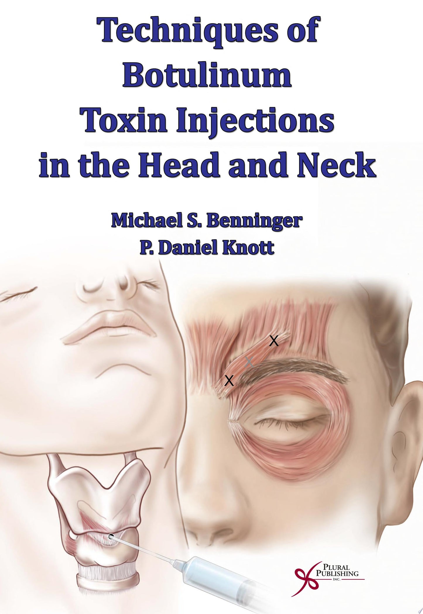 Techniques of Botulinum Toxin: Injections in the Head and Neck