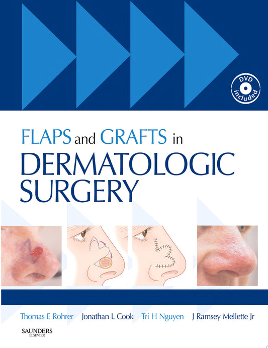 Flaps and Grafts in Dermatologic Surgery, 2nd Edition
