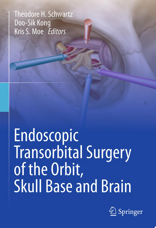 Endoscopic Transorbital Surgery of the Orbit, Skull Base and Brain