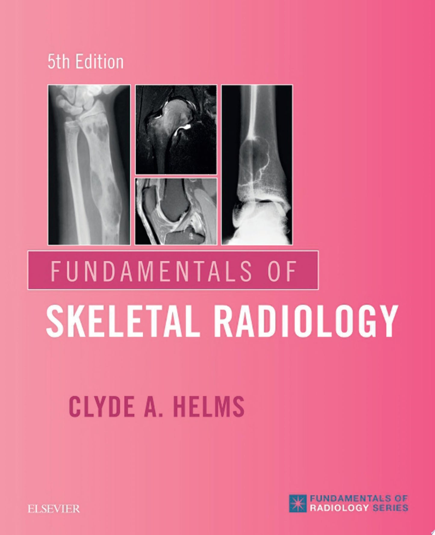Fundamentals of Skeletal Radiology, 4th Edition