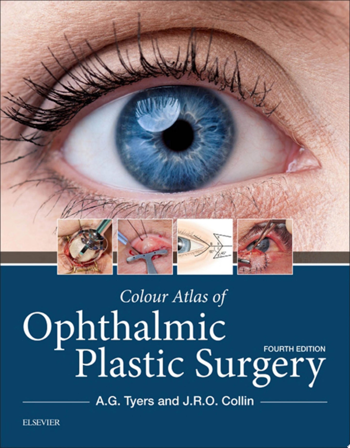 Colour Atlas of Ophthalmic Plastic Surgery, 4th Edition
