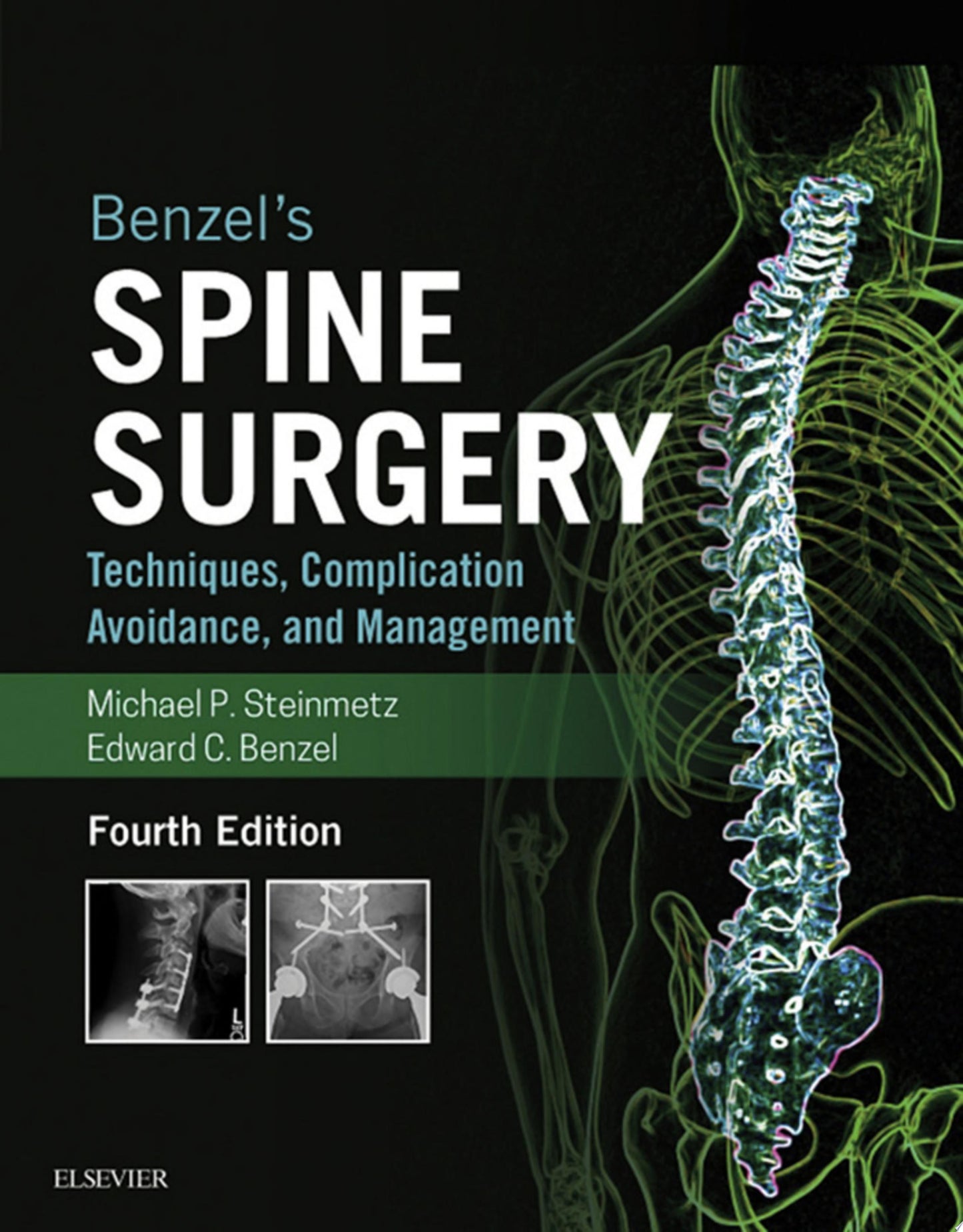 Benzel’s Spine Surgery, 2-Volume Set: Techniques, Complication Avoidance and Management, 4th Edition