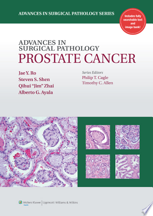 Advances in Surgical Pathology: Prostate Cancer