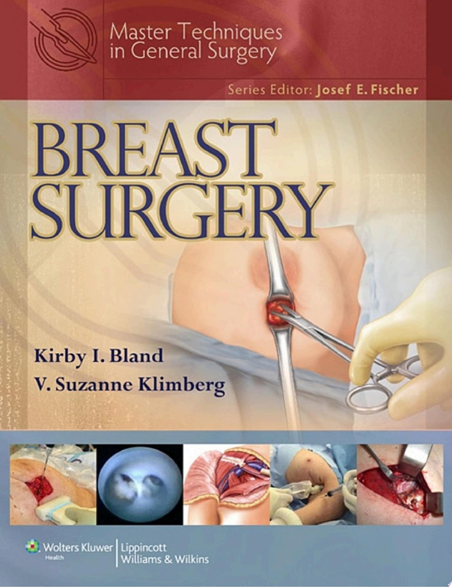 Master Techniques in Surgery: Breast Surgery, 2ed