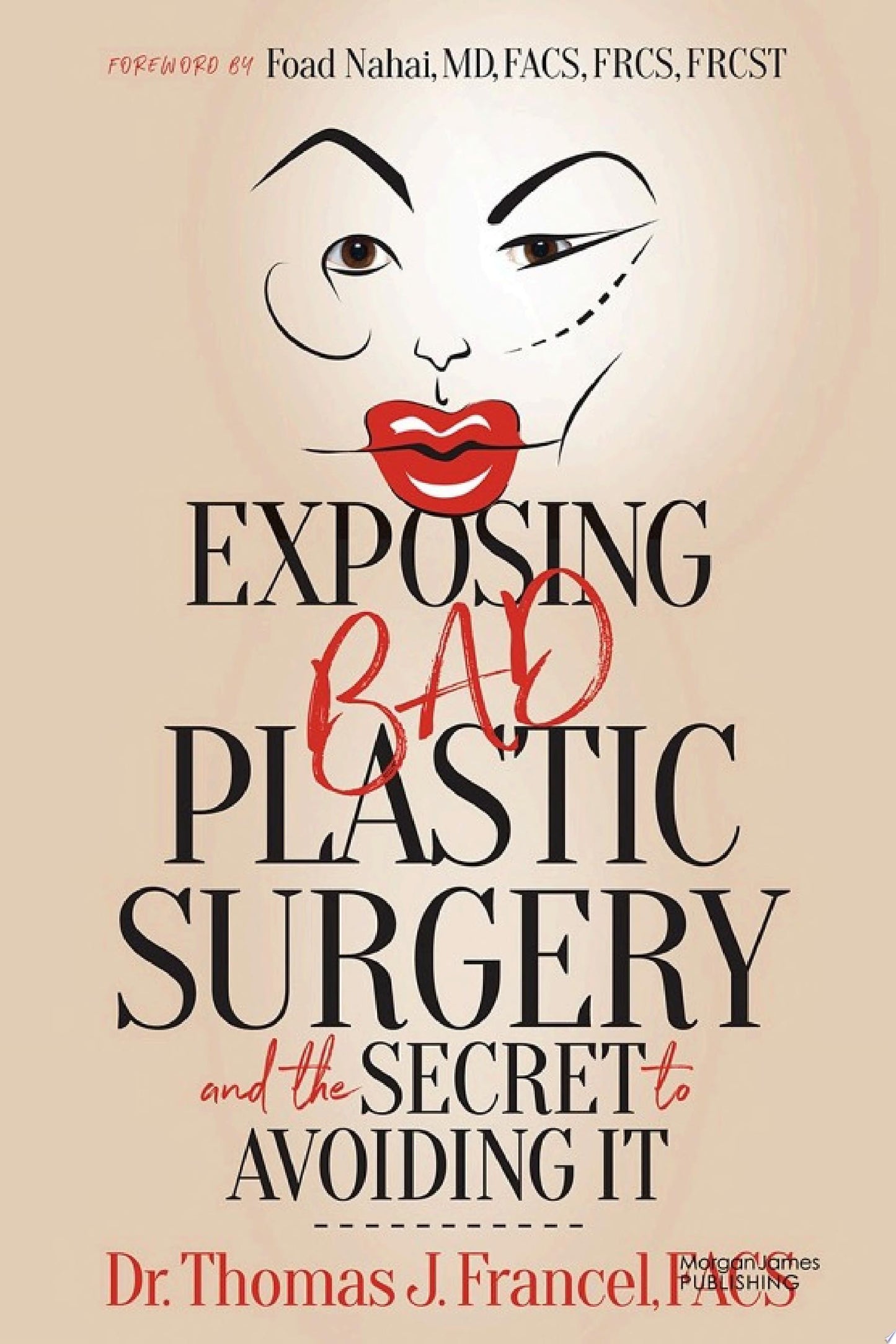 Exposing Bad Plastic Surgery: and the Secret to Avoiding It