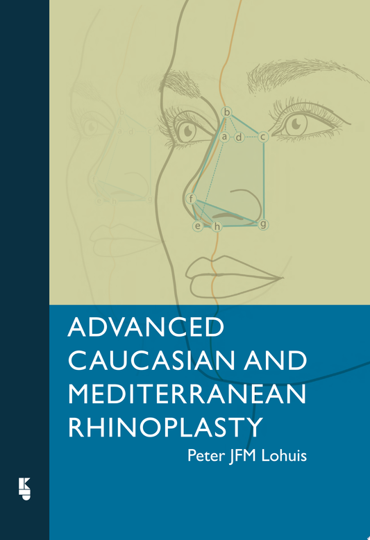 Advanced Caucasian and Mediterranean Rhinoplasty