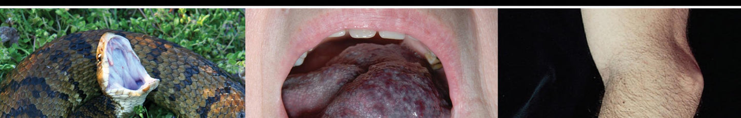 Atlas of Distal Radius Fractures, 1st edition