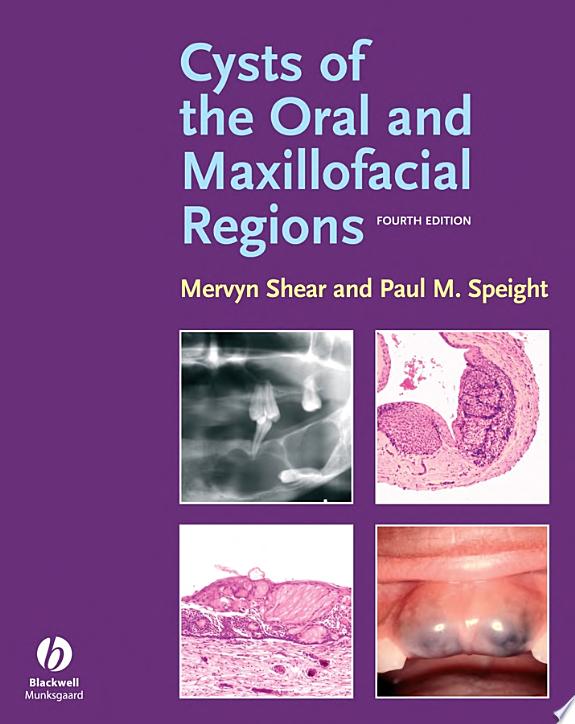 Cysts Of The Oral And Maxillofacial Regions