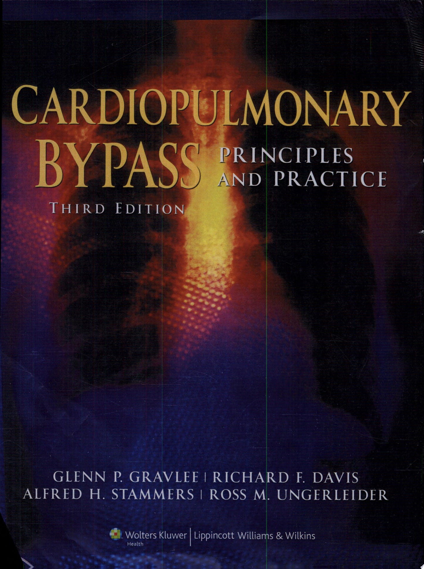 Cardiopulmonary Bypass: Principles and Practice, 3rd Edition