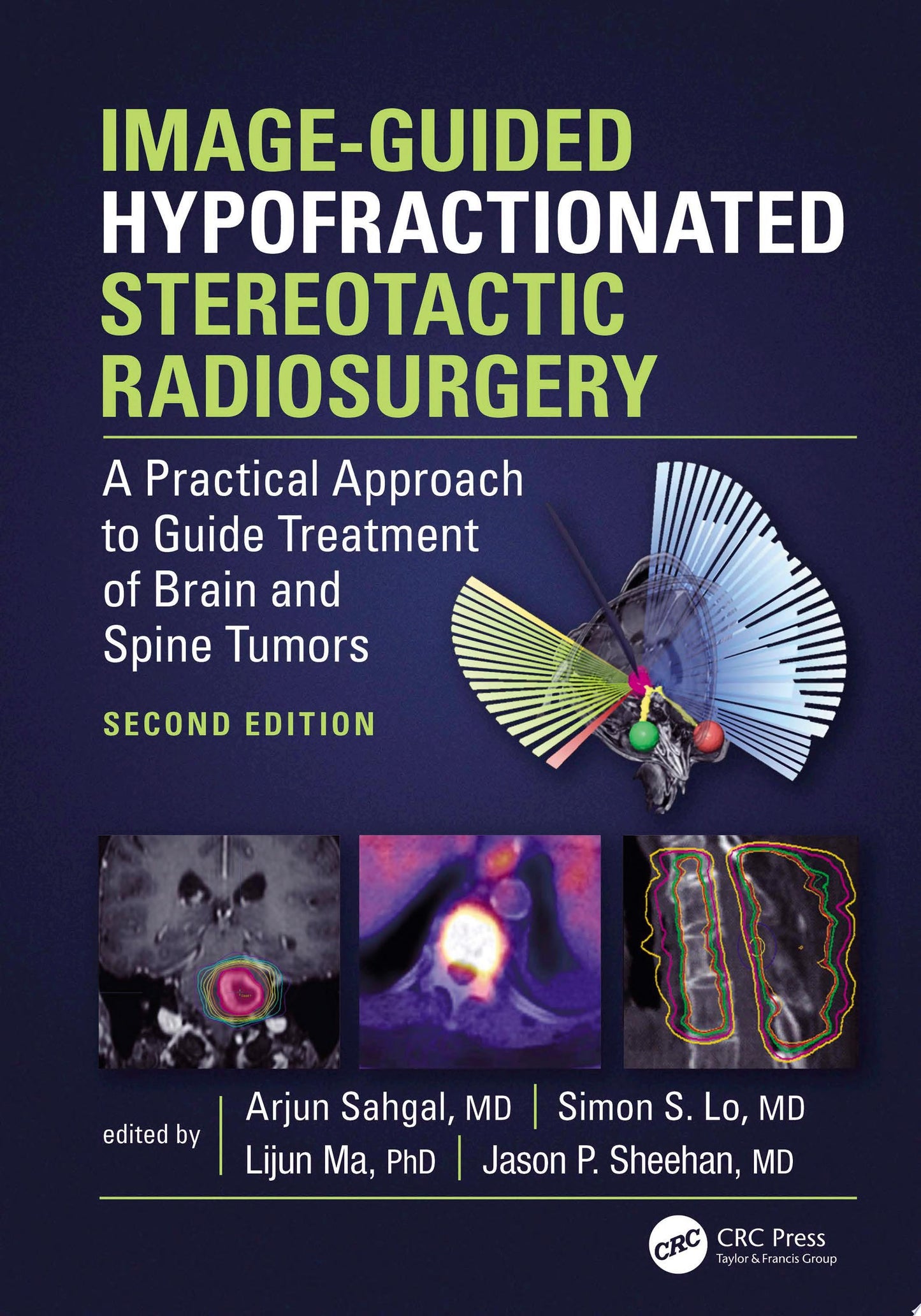 Image-Guided Hypofractionated Stereotactic Radiosurgery: A Practical Approach to Guide Treatment of Brain and Spine Tumors 2nd Edition