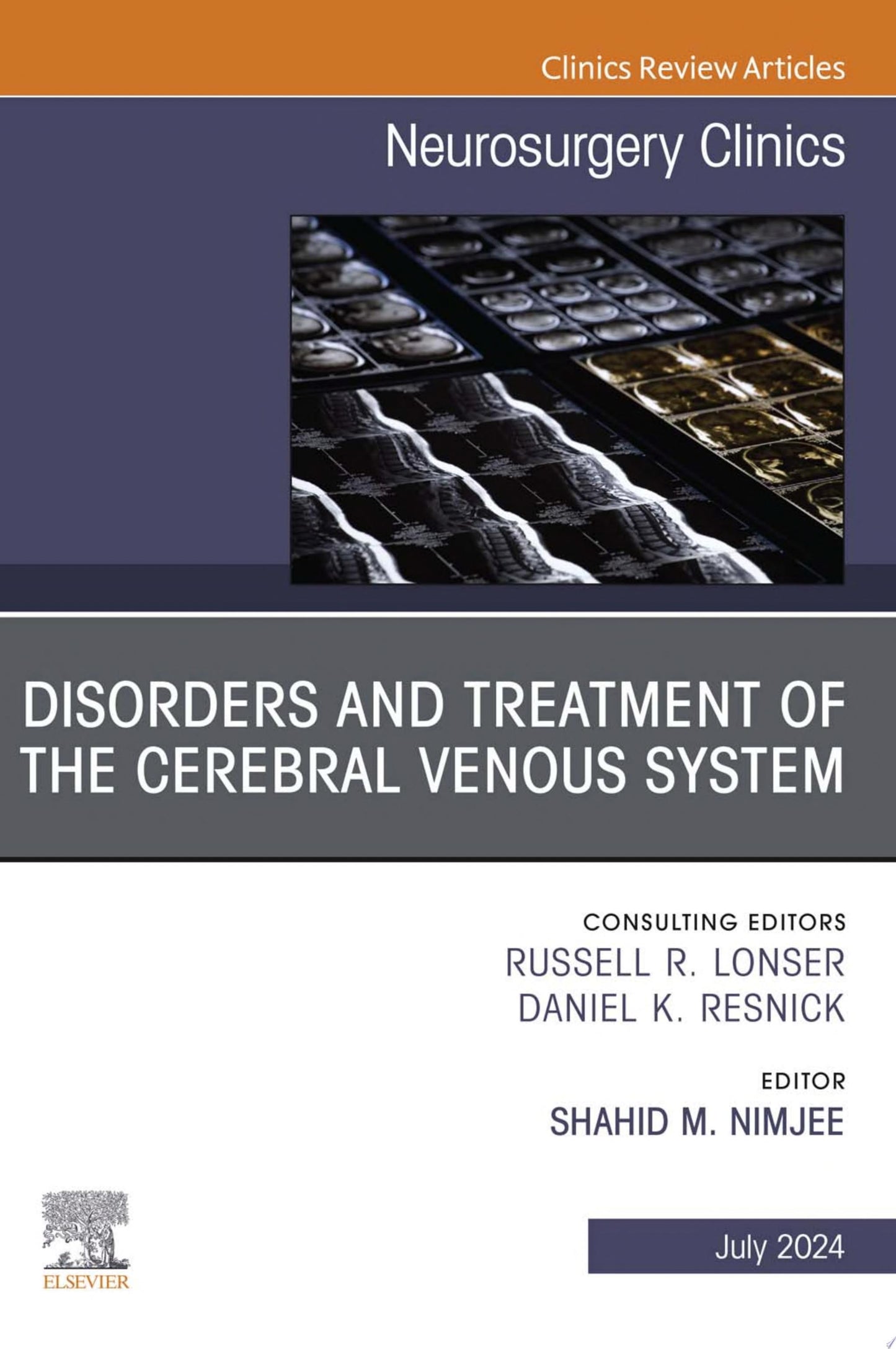 Disorders and Treatment of the Cerebral Venous System, An Issue of Neurosurgery Clinics of North America