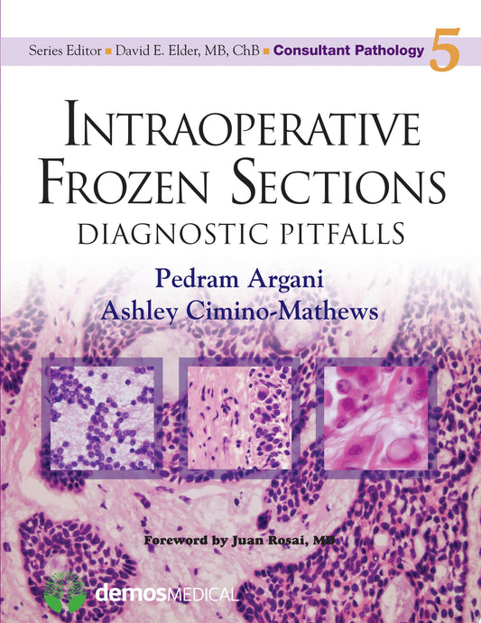 Intraoperative Frozen Sections: Diagnostic Pitfalls