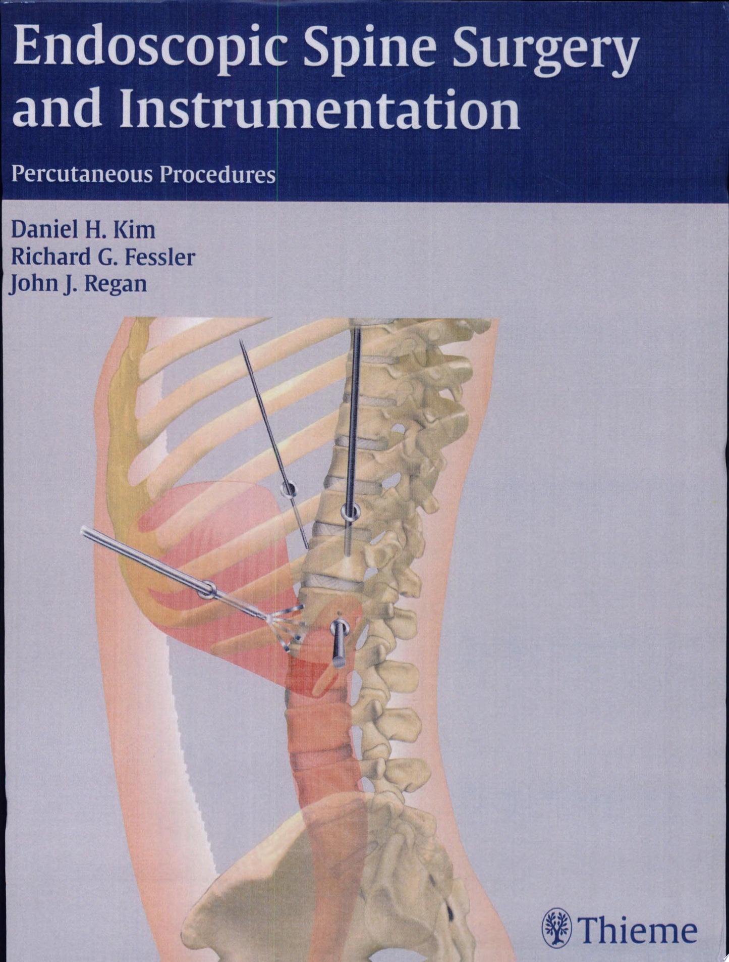 Endoscopic Spine Surgery and Instrumentation