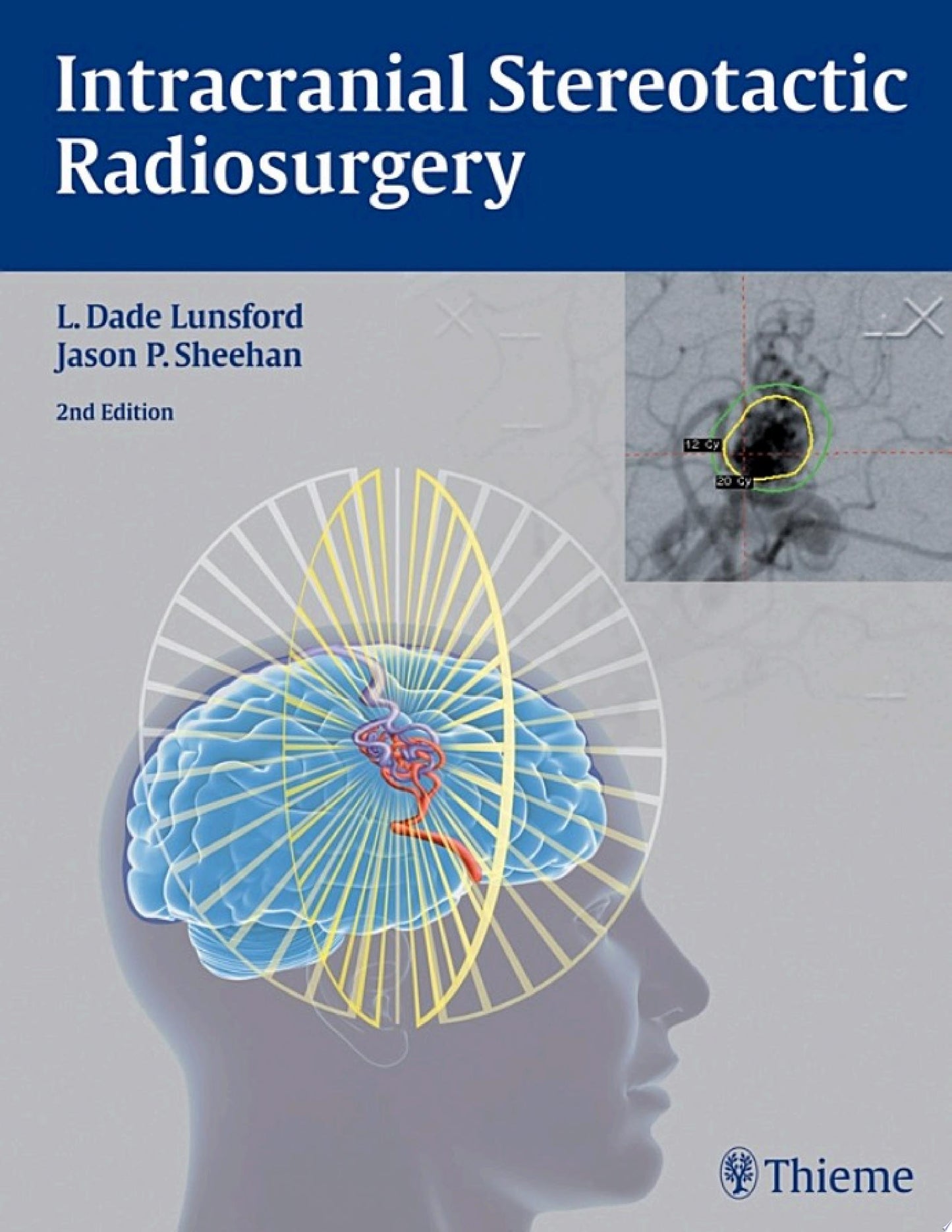Intracranial Stereotactic Radiosurgery, 2nd Edition