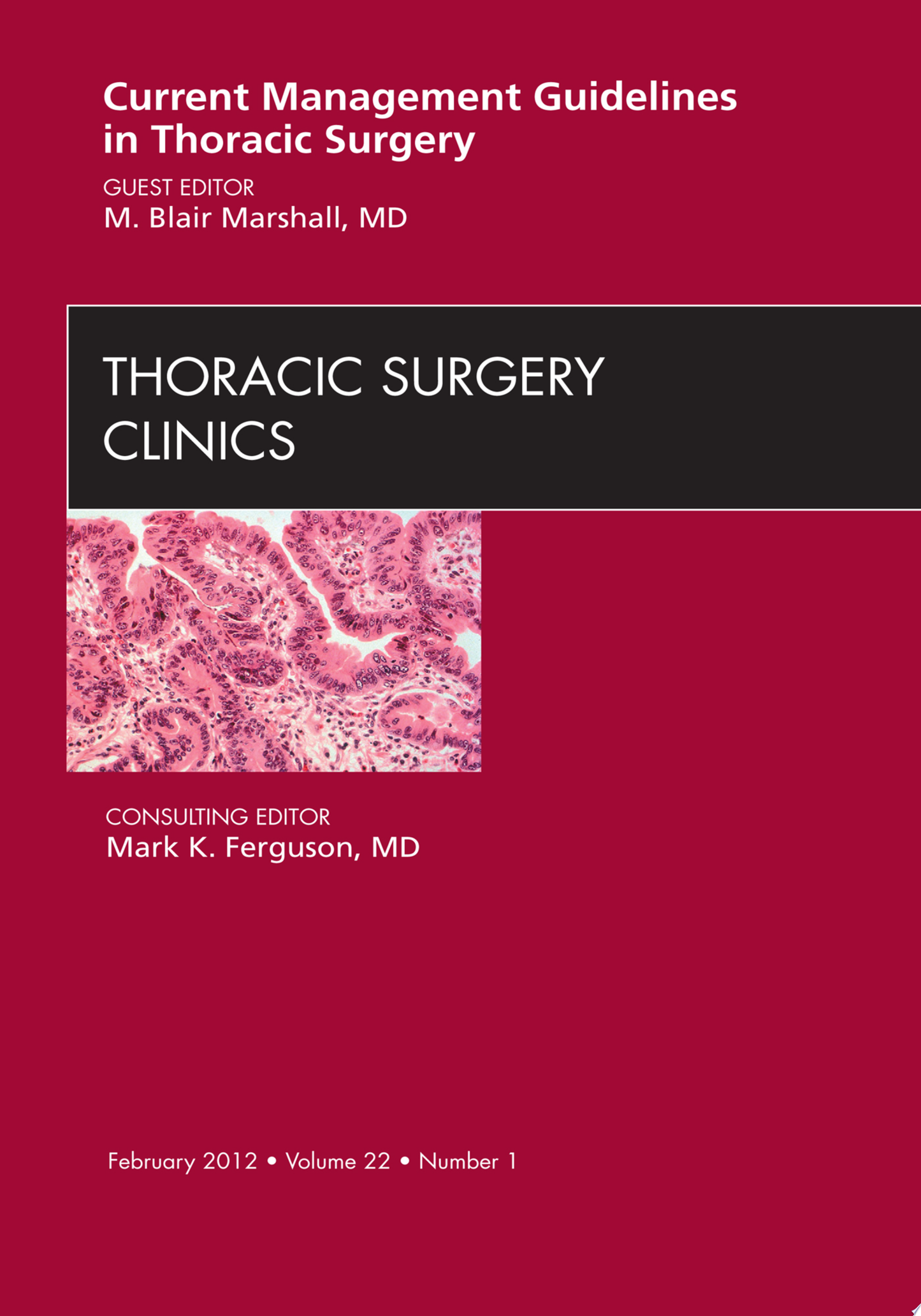 General Thoracic Surgery , 7th Edition