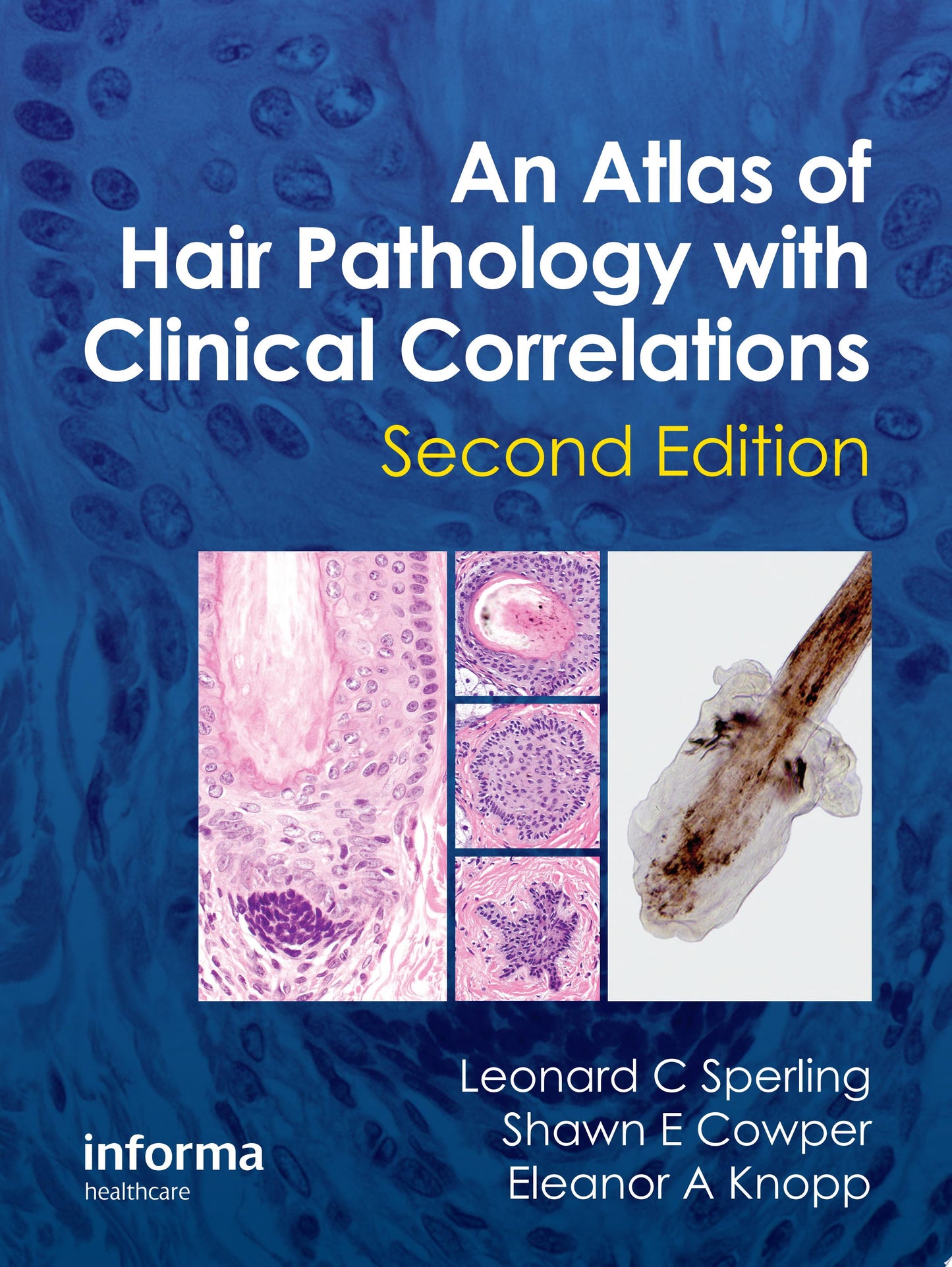 An Atlas of Hair Pathology with Clinical Correlations, 2nd Edition