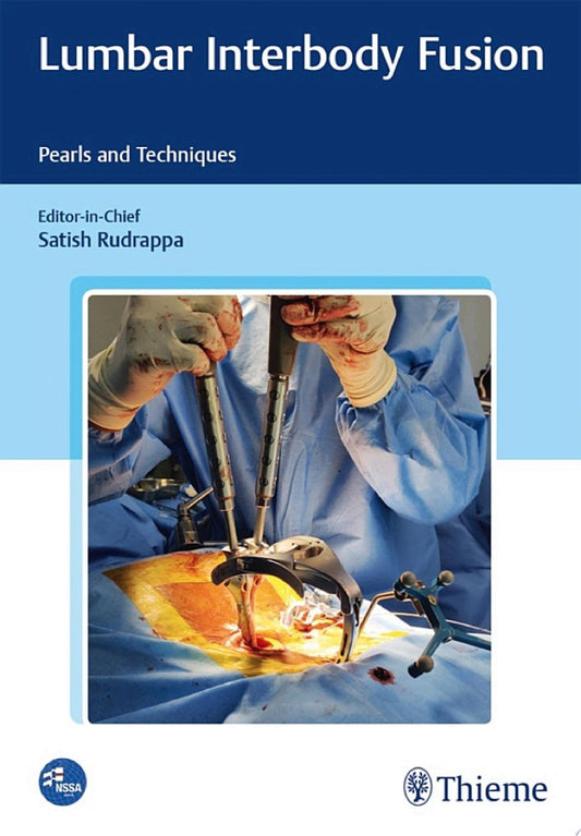 Lumbar Interbody Fusions