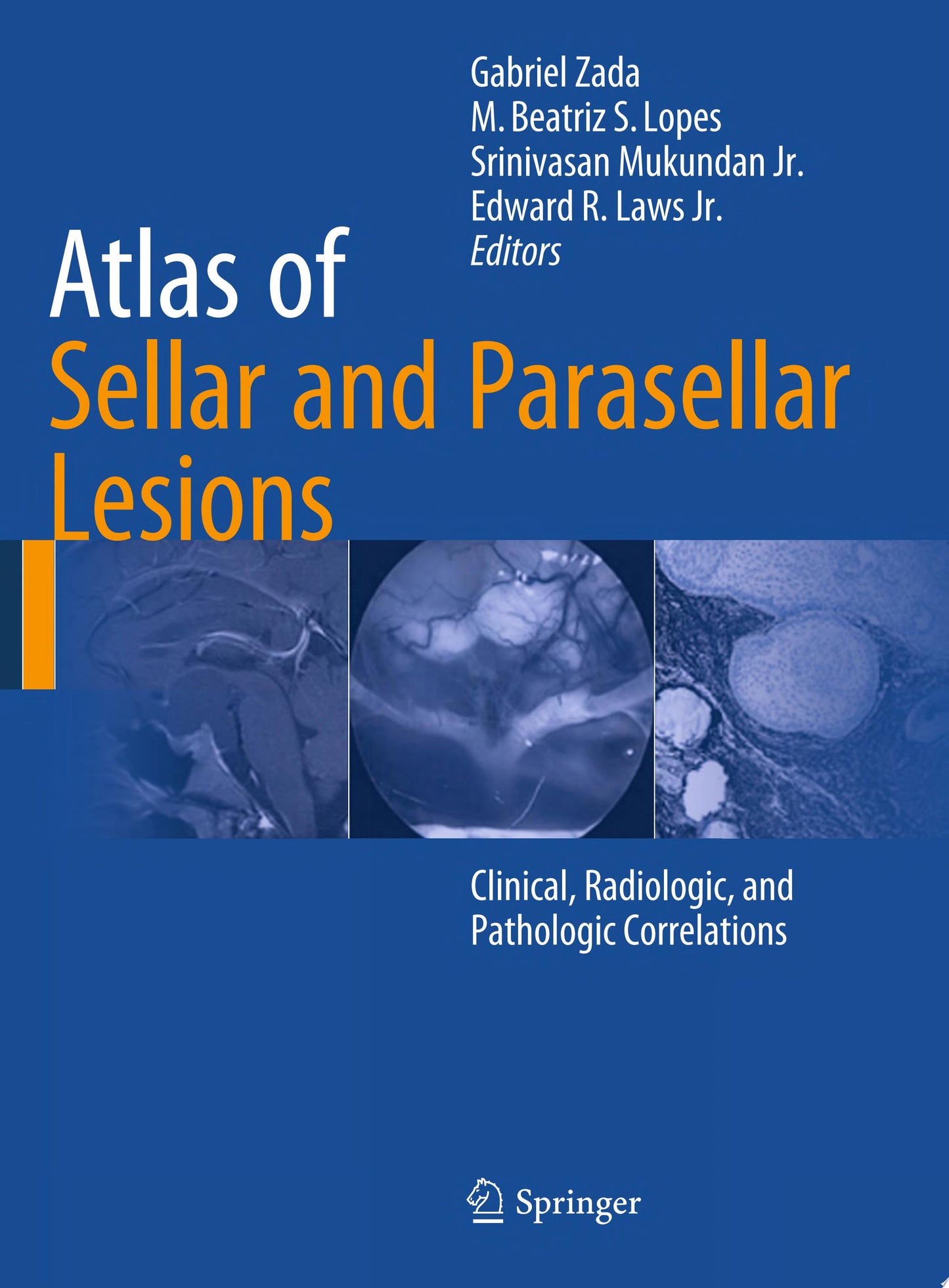 Atlas of Sellar, Suprasellar, and Parasellar Lesions