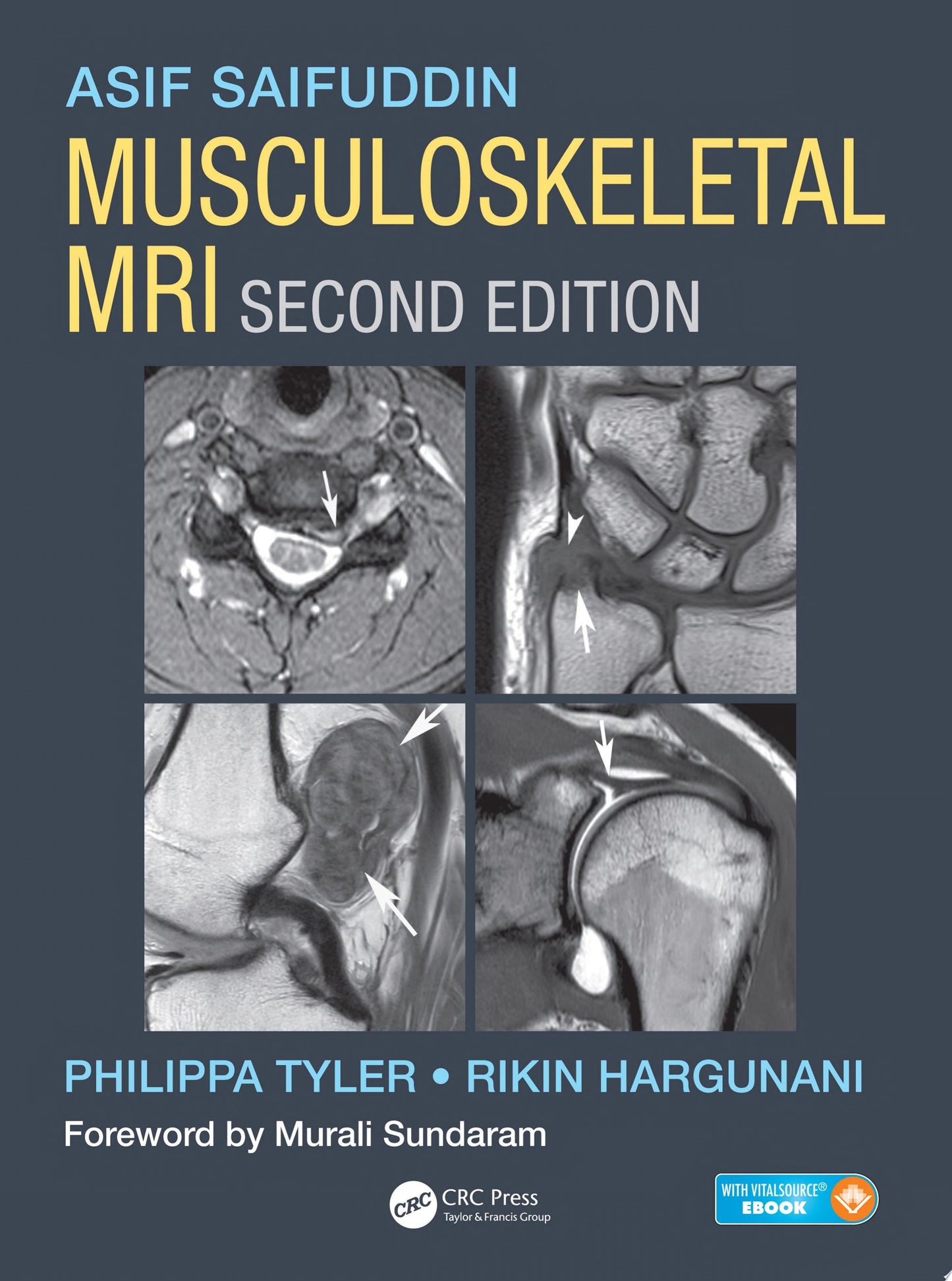 MR Imaging of the Foot and Ankle, An Issue of Magnetic Resonance Imaging Clinics of North America, 1e