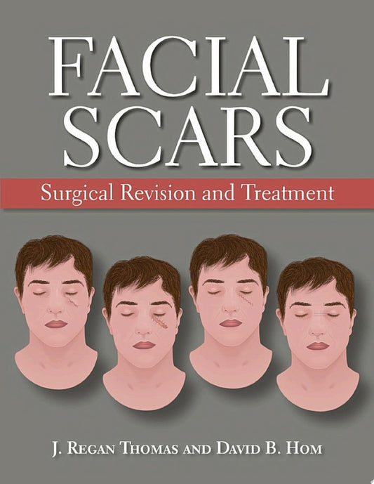 Facial Scars: Surgical Revision and Treatment