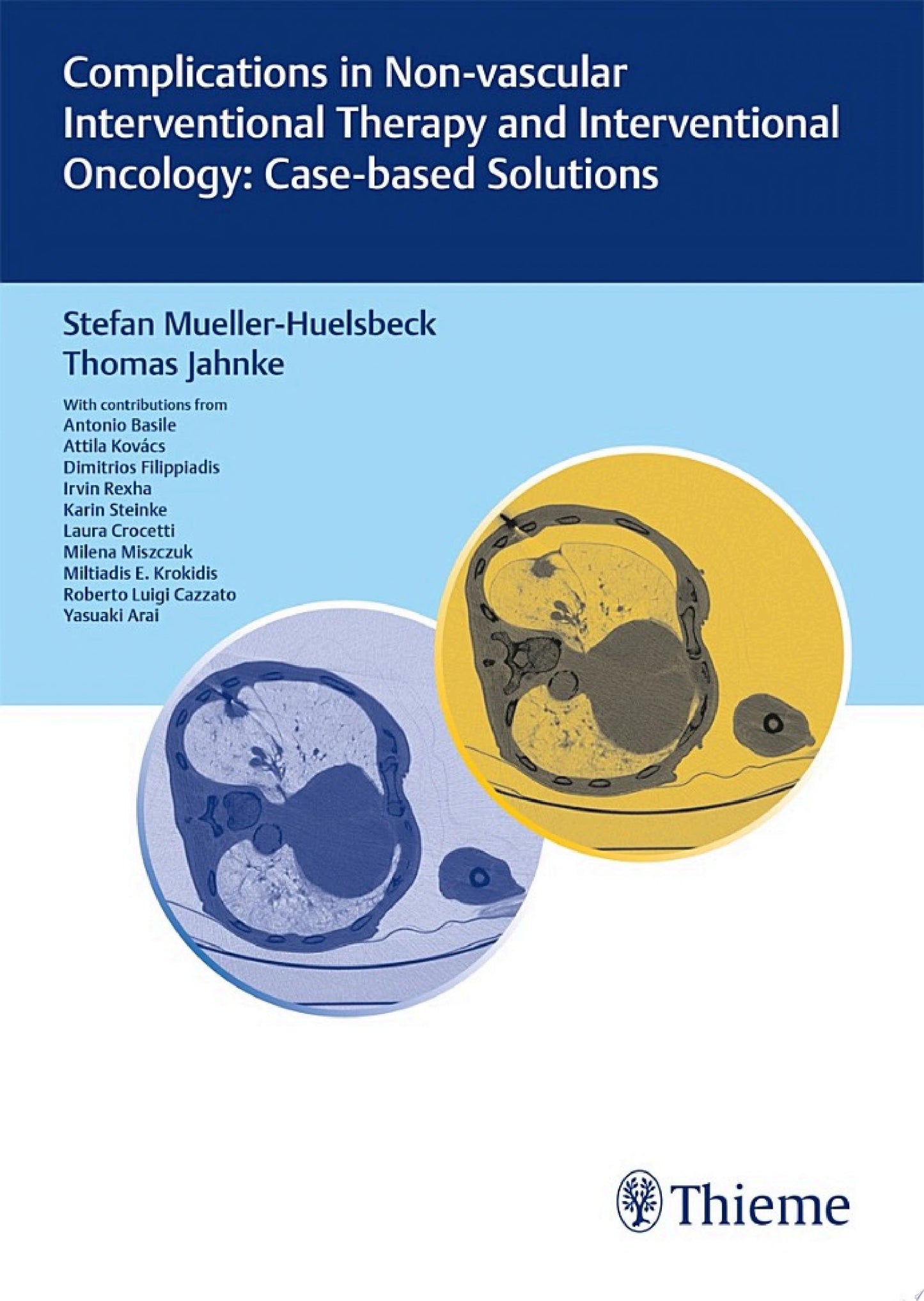 Complications in Non-vascular Interventional Therapy and Interventional Oncology: Case-based Solutions