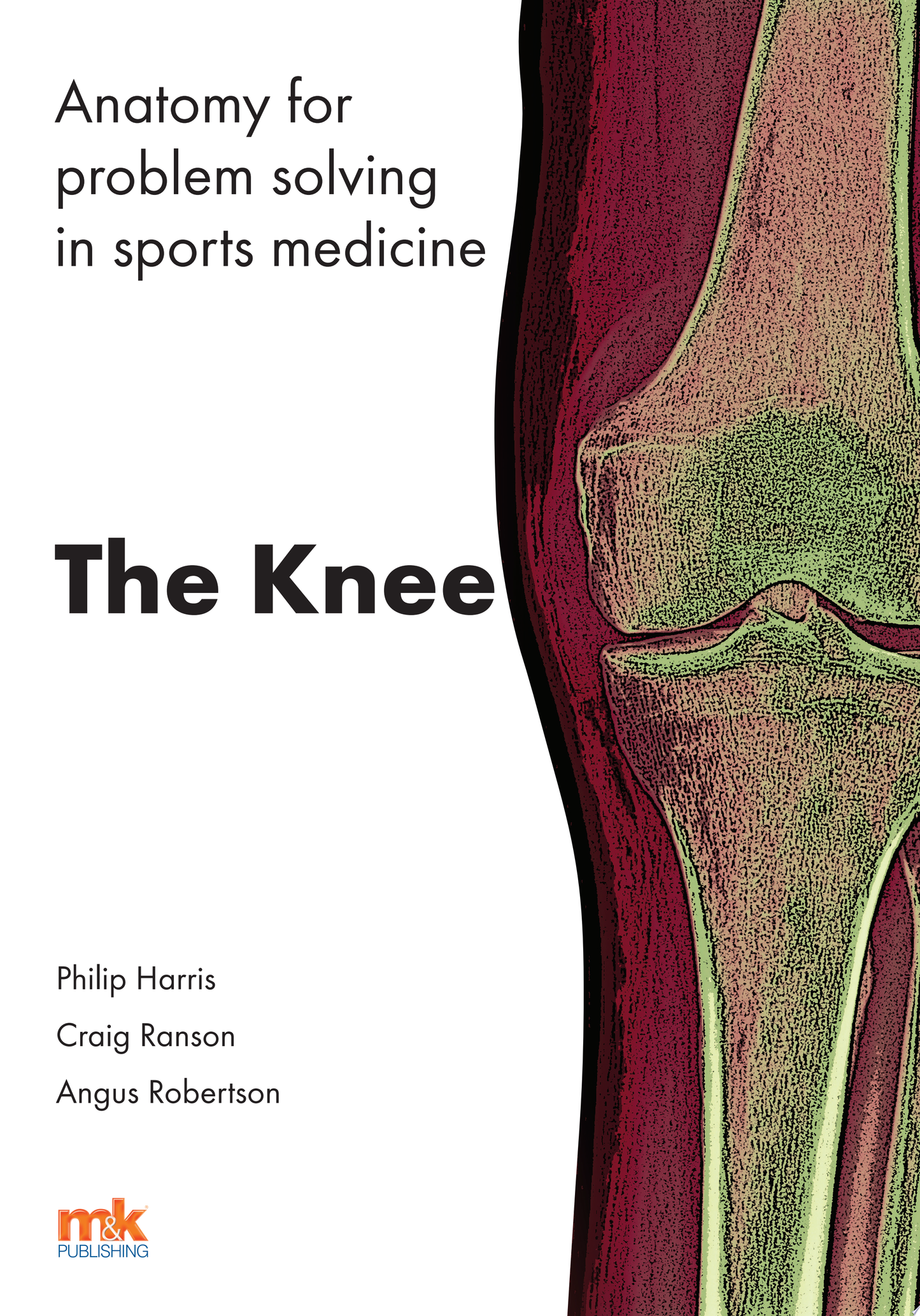 Anatomy for problem solving in sports medicine: The Knee